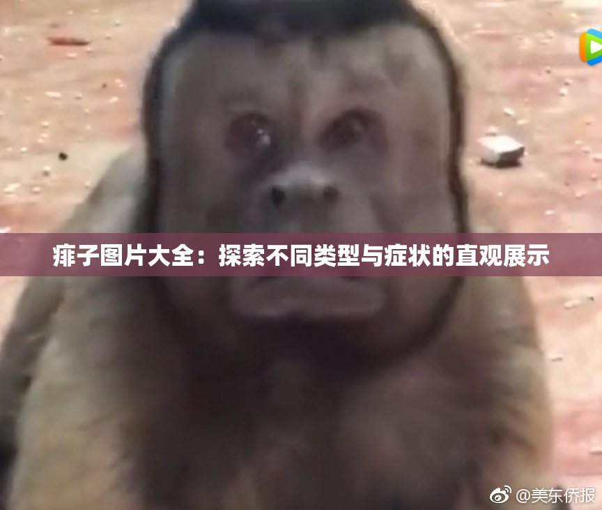 痱子图片大全：探索不同类型与症状的直观展示