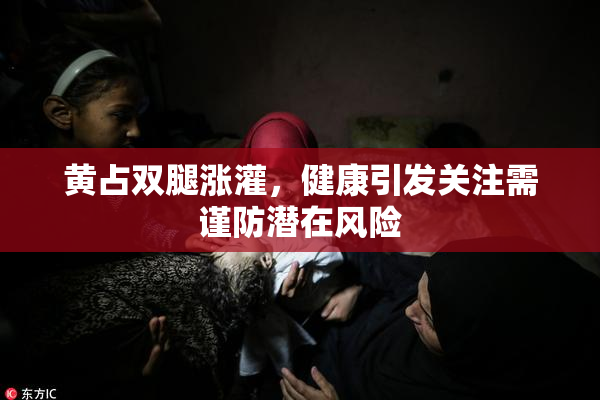黄占双腿涨灌，健康引发关注需谨防潜在风险