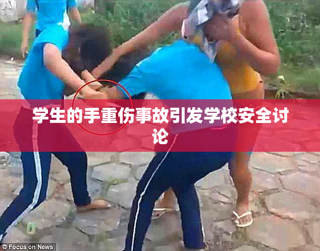 学生的手重伤事故引发学校安全讨论