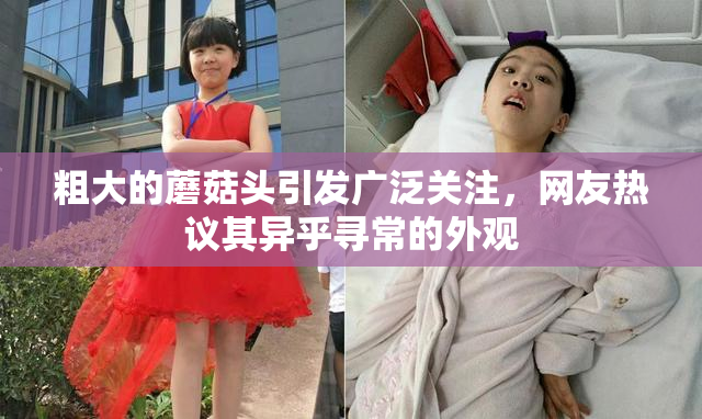 粗大的蘑菇头引发广泛关注，网友热议其异乎寻常的外观