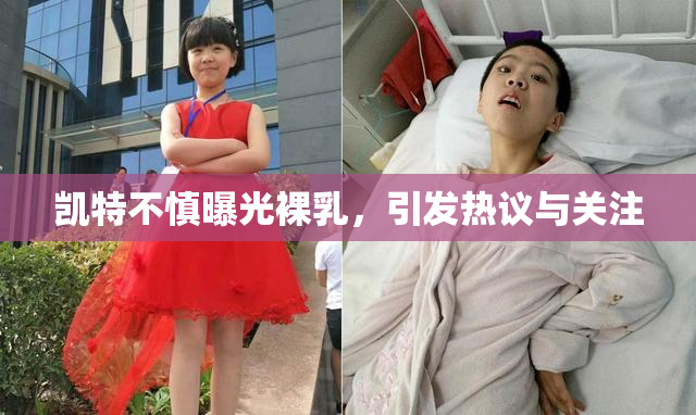 凯特不慎曝光裸乳，引发热议与关注