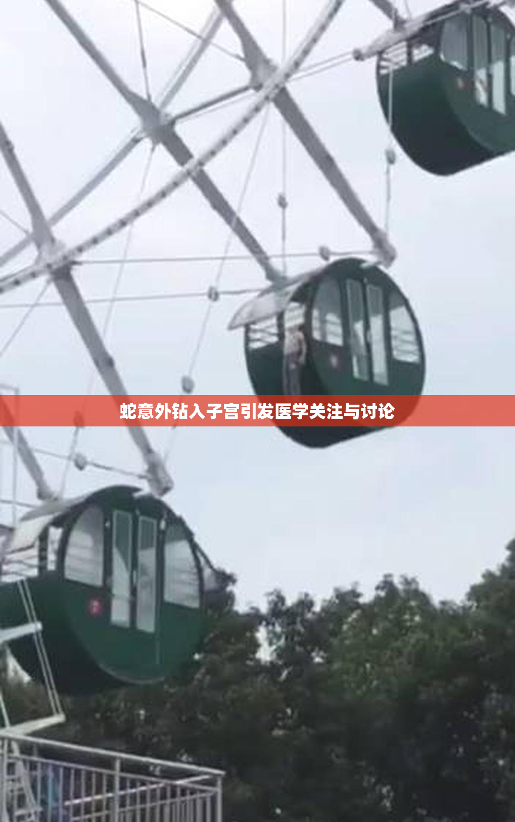 蛇意外钻入子宫引发医学关注与讨论