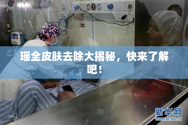 瑶全皮肤去除大揭秘，快来了解吧！