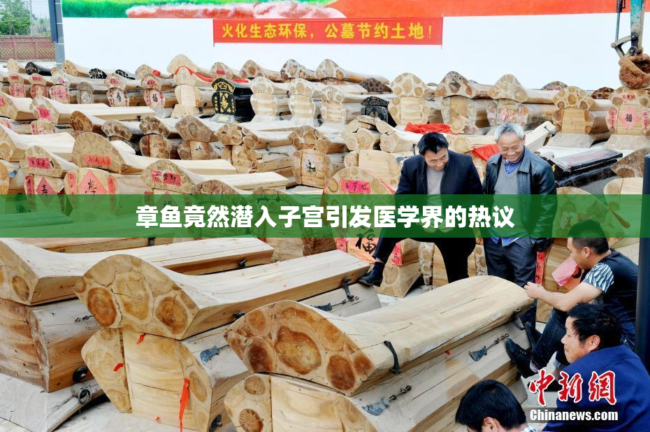 章鱼竟然潜入子宫引发医学界的热议