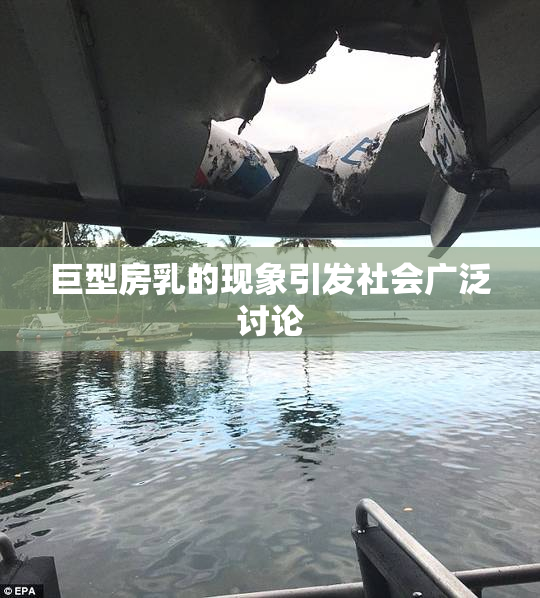 巨型房乳的现象引发社会广泛讨论