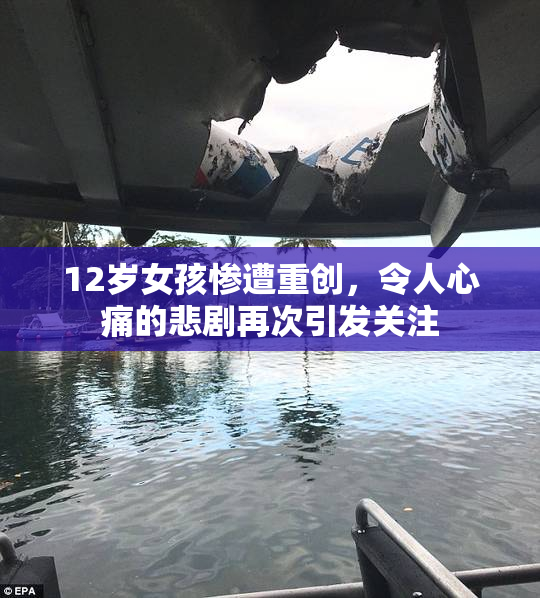 12岁女孩惨遭重创，令人心痛的悲剧再次引发关注